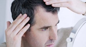 وسواس موکنی - راهنمای کلی درمان اختلال کندن موها